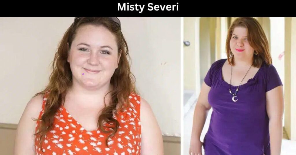 Who Is Misty Severi